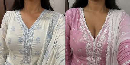 ROSMERA-B रिजल्ट